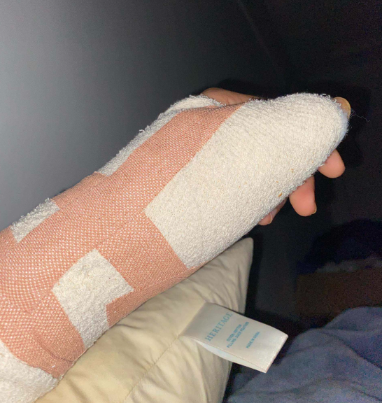Busted my thumb at Oztag. Couldn't work or box